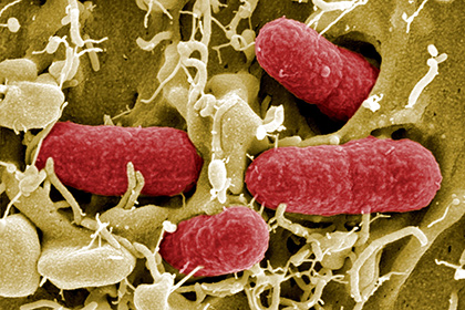 E. Coli